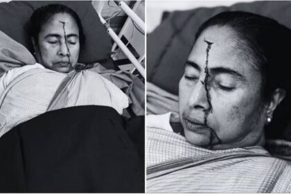 Mamata Banerjee Injury