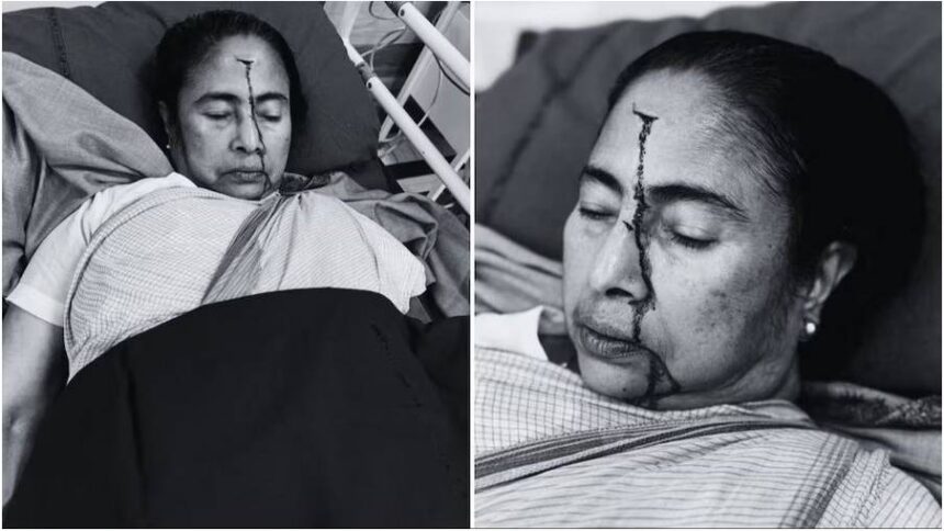 Mamata Banerjee Injury